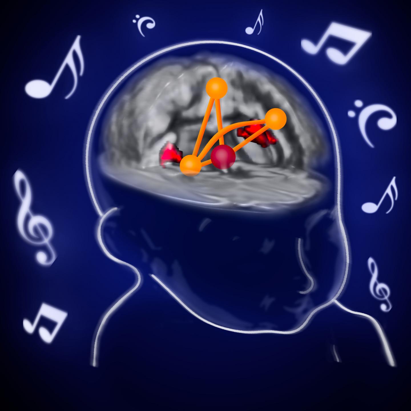 Music exposure in neonatal intensive care units improves salience network connectivity