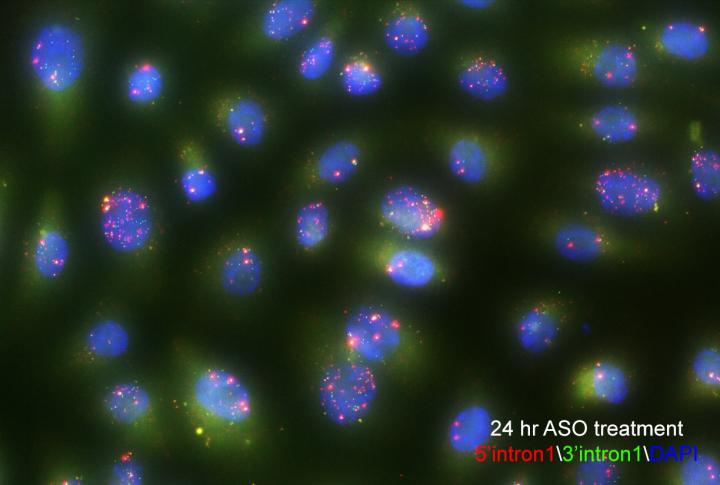 New High-Throughput Method to Study Gene Splicing at an Unprecedented Scale