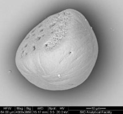 Side of Otolith