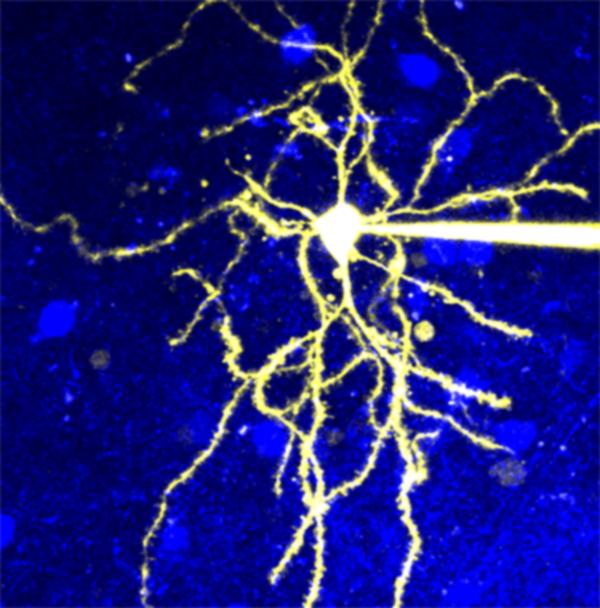 Microscopic Image of a Neuron that Expresses D2R