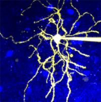 Microscopic Image of a Neuron that Expresses D2R