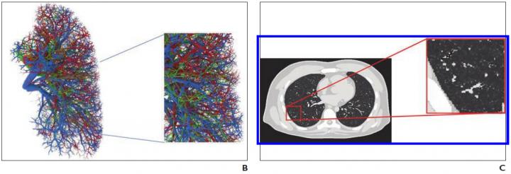 Example of 4D XCAT Phantom Developed at Duke