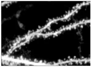 Dendritic spines