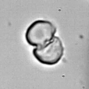 Slow-Motion Freezing in Cell Pair