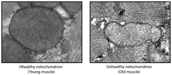 Healthy vs. Unhealthy mitochondrion