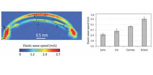 A newly developed noninvasive imaging technique combines acoustic radiation force and optical coherence tomography to produce 3D elastic wave speed maps of multiple eye components simultaneously.