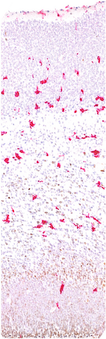 Microscopy image of human microglia