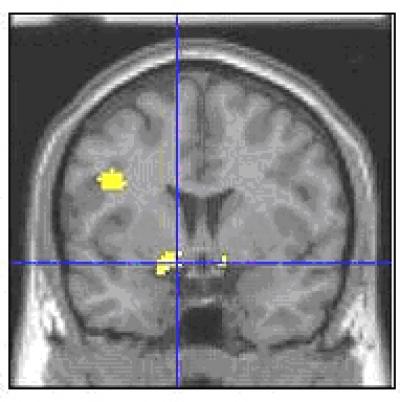 fMRI Data