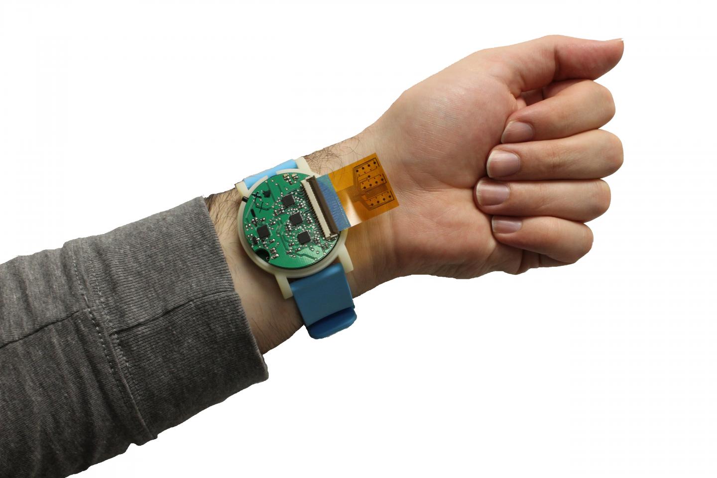 'Wristwatch' Monitors Body Chemistry