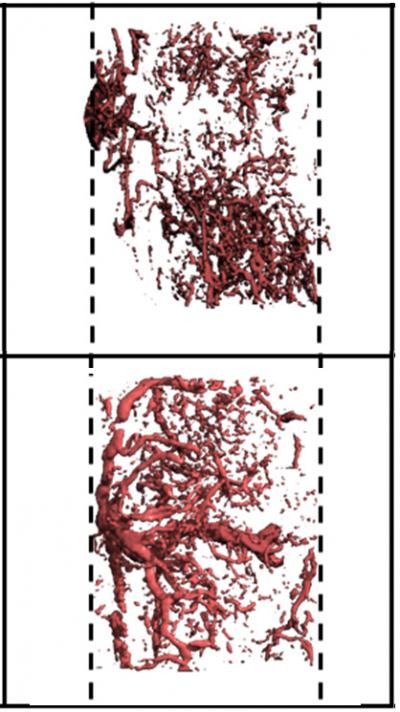 Blood Vessel Formation