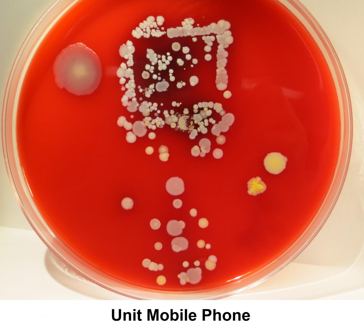 Yuck Factor May Boost Hand Hygiene Compliance (2 of 3)