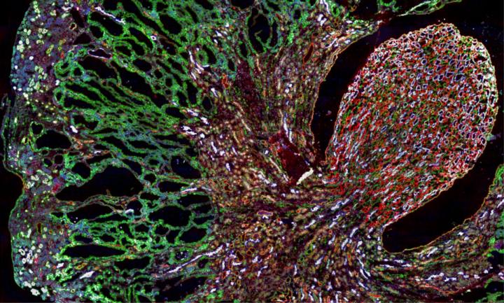 Misfolded Protein