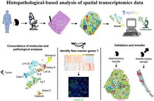 Histopathological-based analysis of spatial transcriptomics data