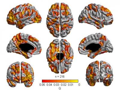 Results of Cortical Thickness Regressed Against the Cognitive Factor