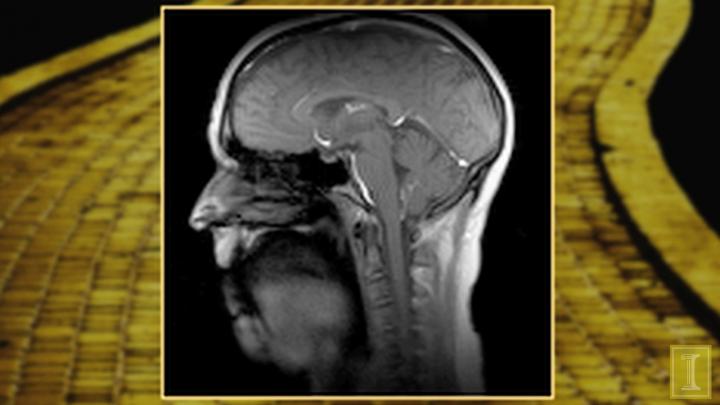 New Real-Time MRI Technique