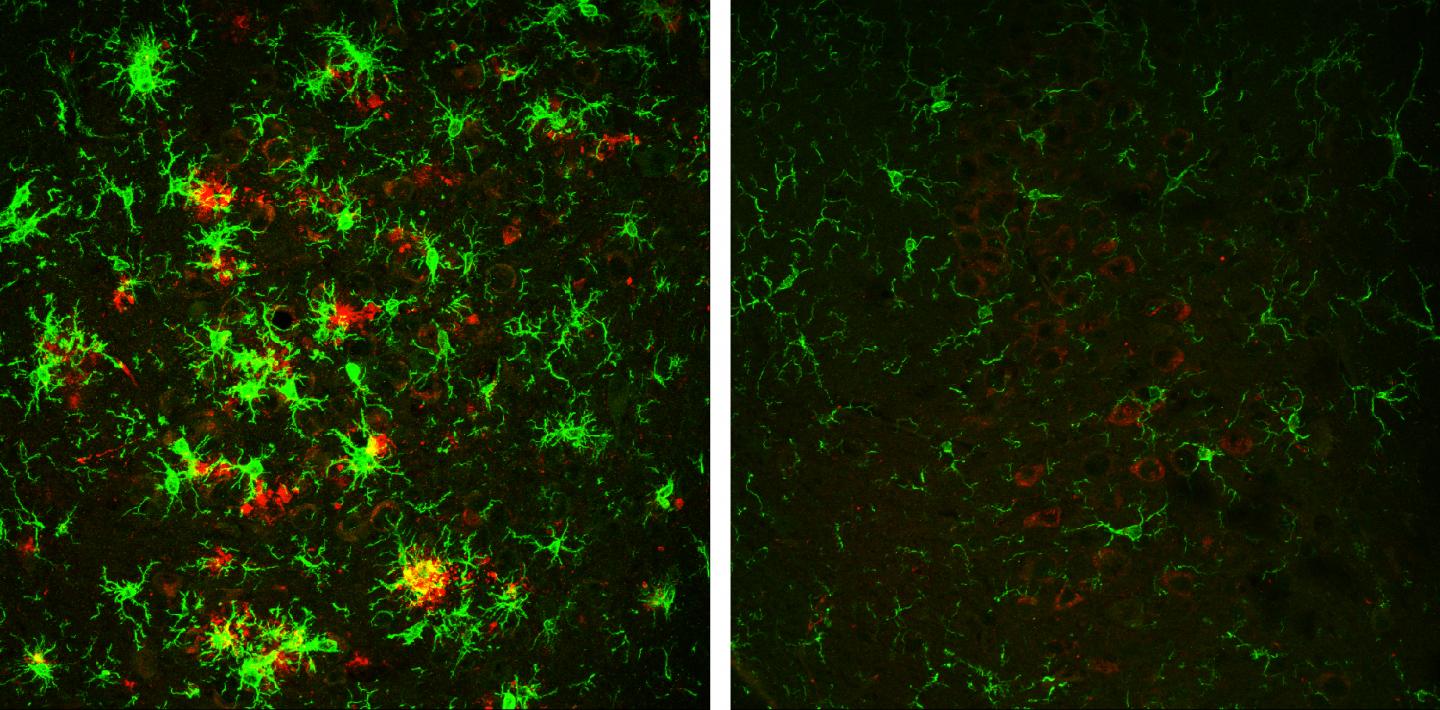 BACE1 Depletion Reverses Alzheimer's Disease in Mouse Model