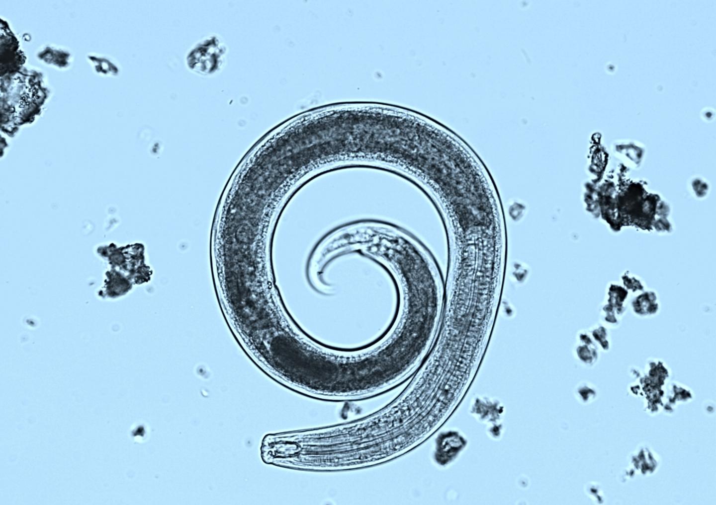 Nematode under microscope.