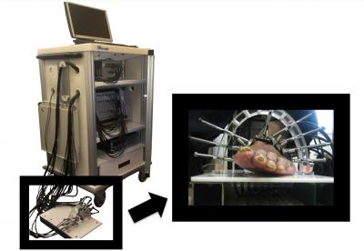 DDOT Imaging of Peripheral Arterial Disease