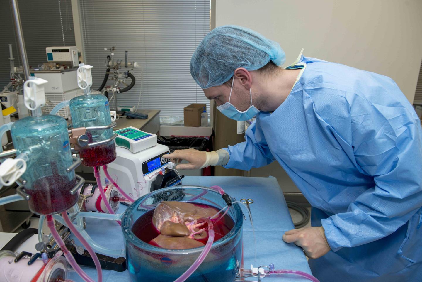 Supercooled Human Liver for Transplant