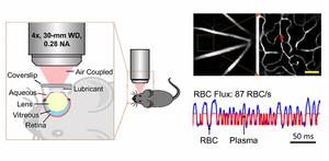 A new technique for retinal optical imaging utilizes a two-photon microscope to quantify the flux of red blood cells in microscopic capillaries within the retina.