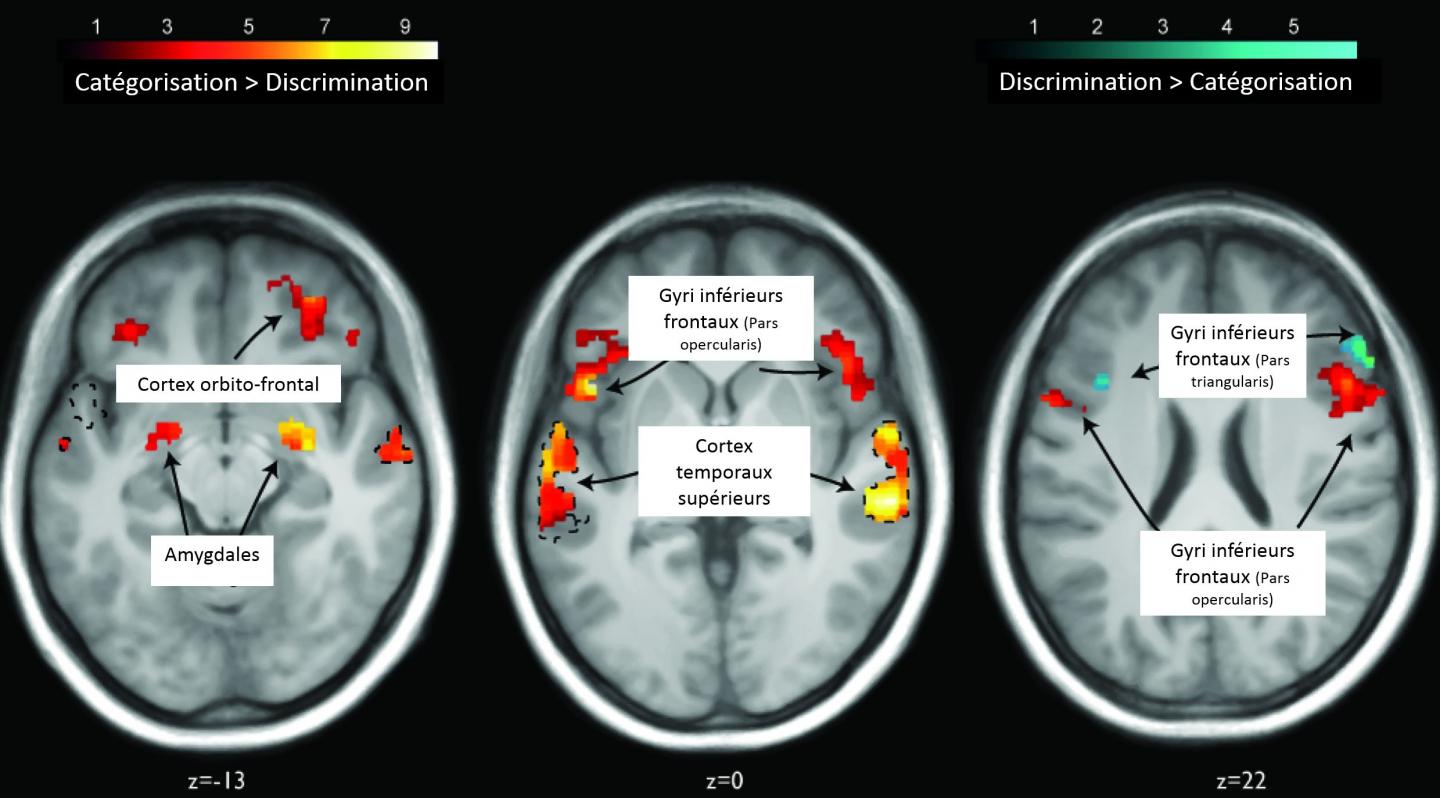 Different Cerebral Activations in Response to Categorization