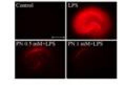 Paeonol Inhibited Lipopolysaccharide-Induced Hippocampal Cell Death