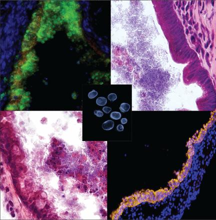 Human Instestinal Organoids