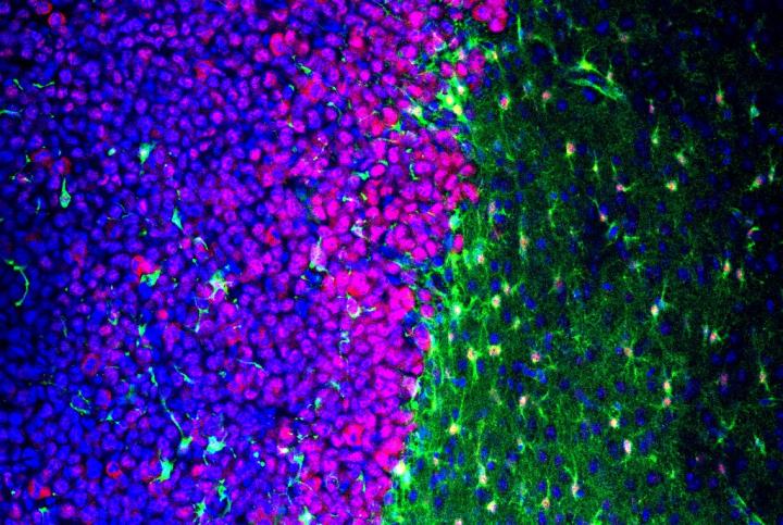 Altering Astrocytes