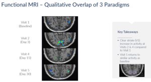 Functional MRI from ABACUS study