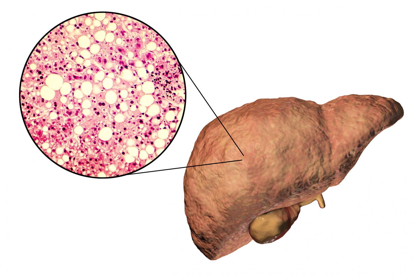 Osteopontin and Liver