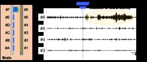 Fig. 3 Recording of neural activity in the mouse brain induced by LED light stimulation at a specific site.