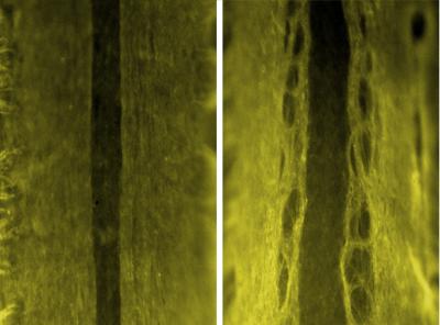 Dystroglycan Organizes Axons of the Spinal Cord