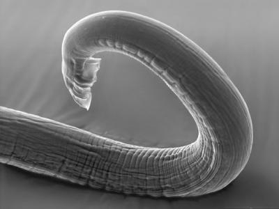 Microscope Image of Roundworms