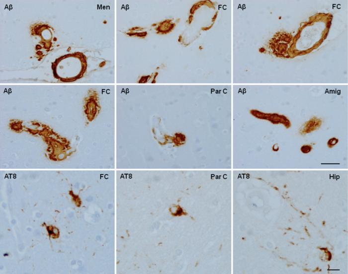 Brain aging and Alzheimer’s disease, a perspective from non-human primates