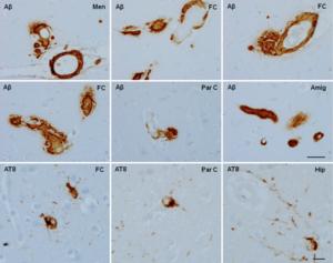 Brain aging and Alzheimer’s disease, a perspective from non-human primates