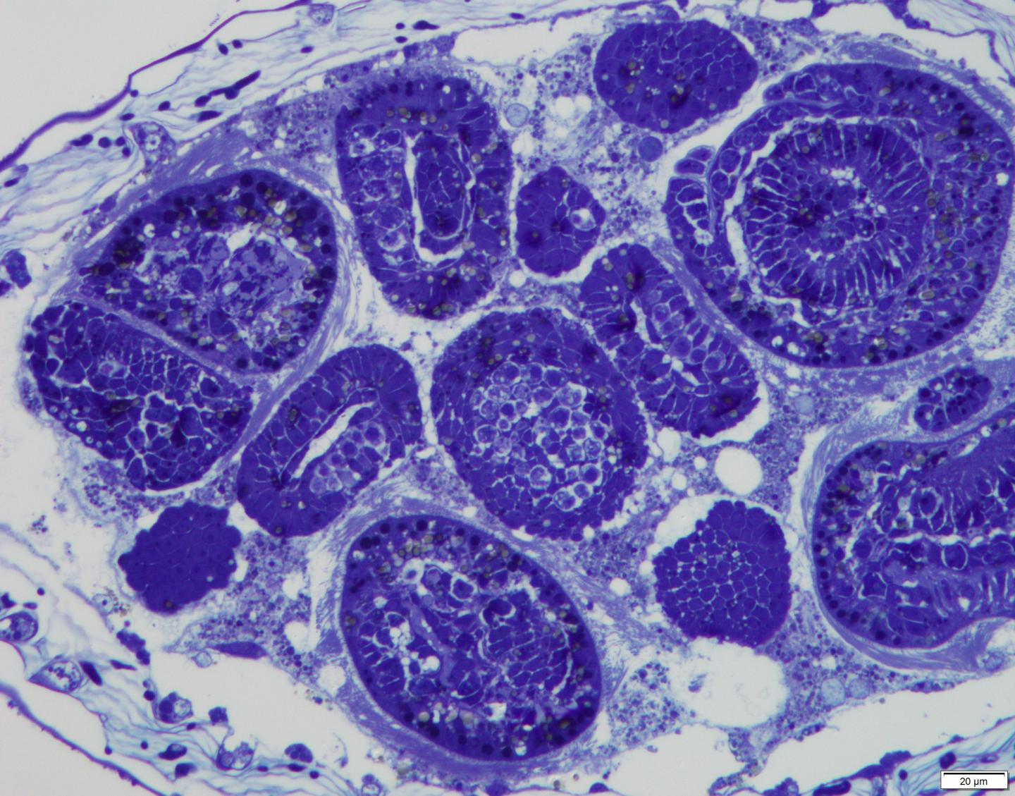 The histological section of a gonozooid