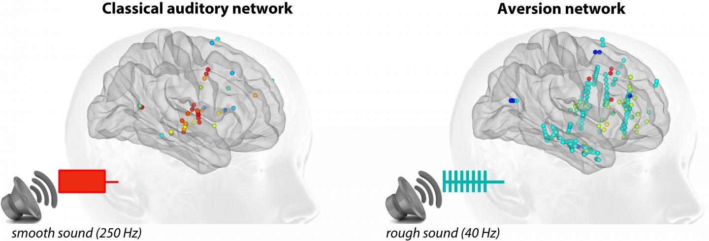 Why Is the Brain Disturbed by Harsh Sounds?