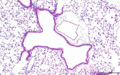 H&E-Stained Section of Lungs in C57Bl/6 Neonatal Mice