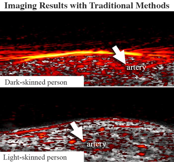 Medical Imaging Fails Dark Skin. Researchers Fixed It