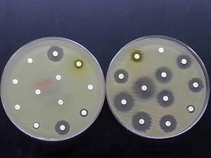 Lab test for antibiotic sensitivity and resistance