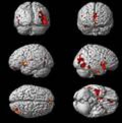 3-Dimensional Coronal Image