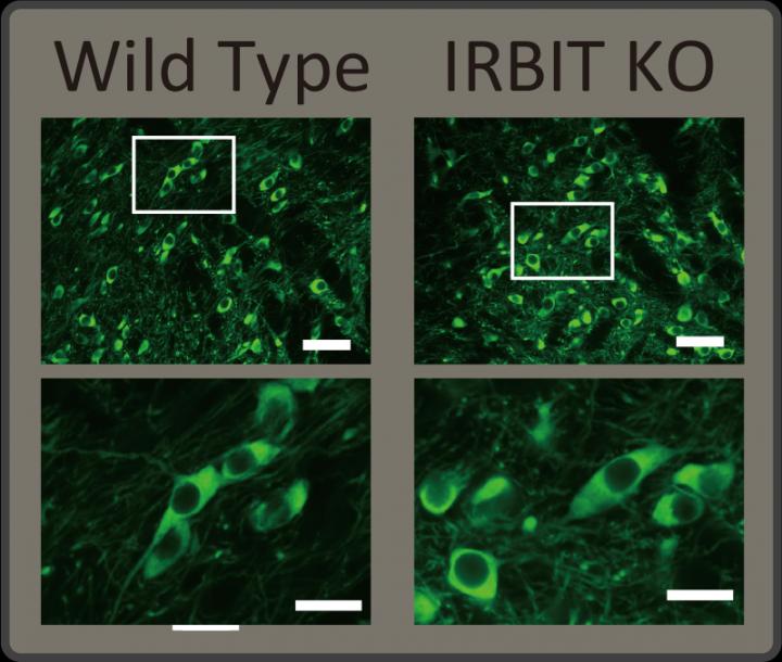 Phosphorylated Tyrosine Hydroxylase Increases in IRBIT KO Mice