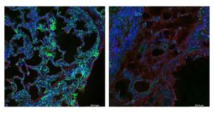 Researchers Identify Protein Sensor that Plays a Role in Lung Fibrosis