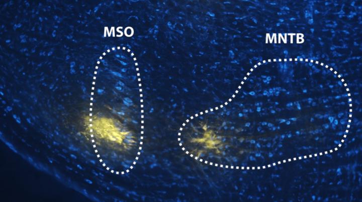 Precise anatomical targeting and physiological validation of MNTB neurons during in vivo extracellular recording.