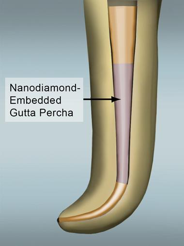 Nanodiamonds for Root Canals