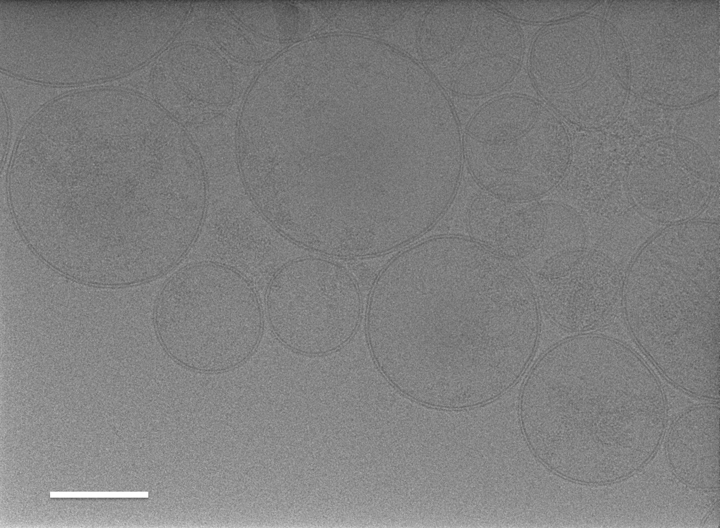 Tick Exosomes May Aid Transmission of Viruses to Vertebrates