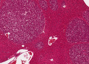 Liver tissue of a diseased mouse