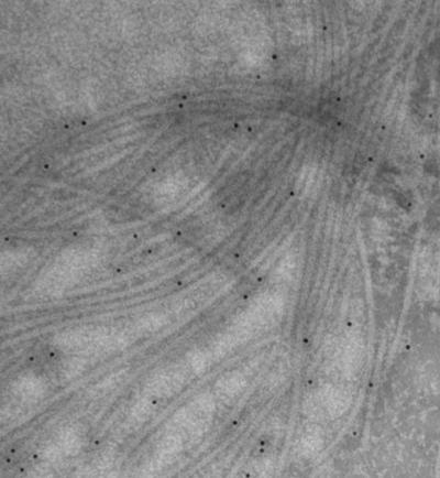Image of Isolated Flagella