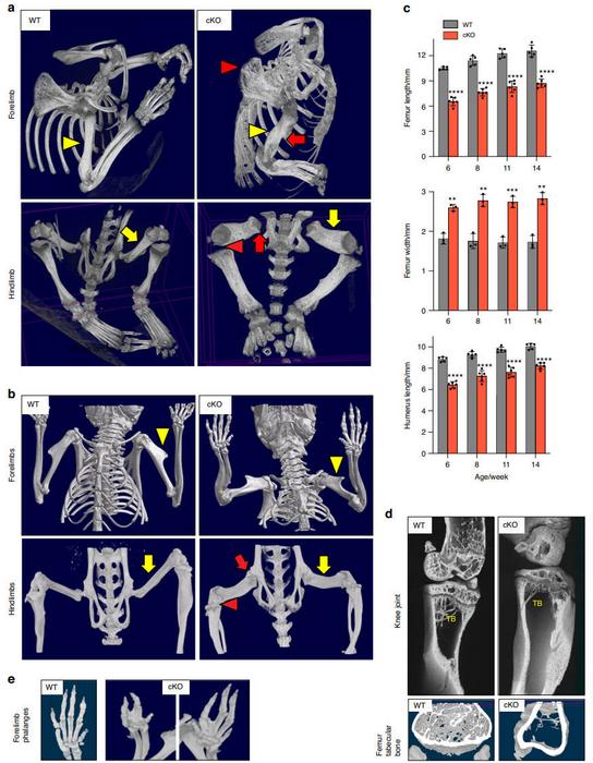 Severe and persistent defects in multiple bones and joint in Lrp1flox/flox/Prrx1Cre mice. Representative images of in vivo X-ray analysis of limbs of 2-week-old (a) and 14-week-old (b) WT and Lrp1flox/flox/Prrx1Cre homozygote conditional KO (cKO) mice.