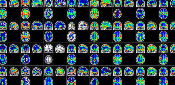 Network activation map from the output of second temporal convolution layer mapped onto MNI brain atlas.